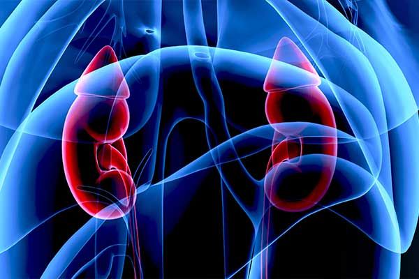 Cushing-Syndrom: Akute Komplikationen und Folgen des Hypercortisolismus
