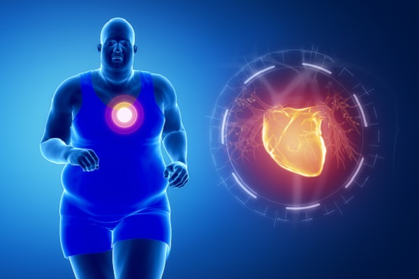 Fortbildung: Herz und Hirn im Risiko – KHK, Schlaganfall und HFpEF bei Adipositas