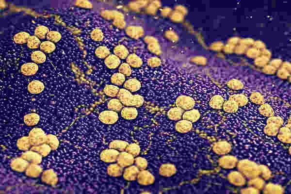 Hygienebeauftragter Arzt – Refresher Kurs Lektion 2/2 (kostenpflichtig) November 2019