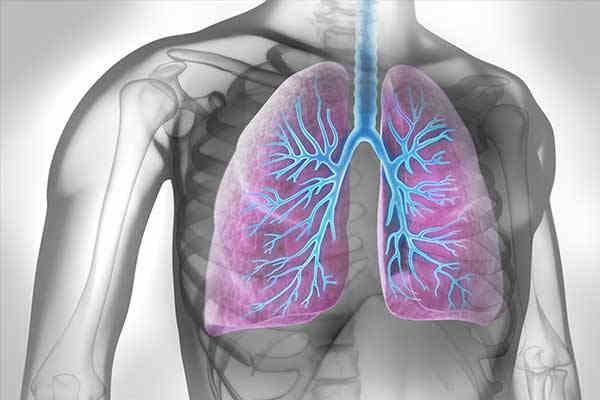Fortbildung: Antifibrotische Therapie bei progredienter exogen-allergischer Alveolitis: Starten wir zu spät?