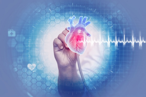 Der kardiogene Schock – Vorschlag einer SOP